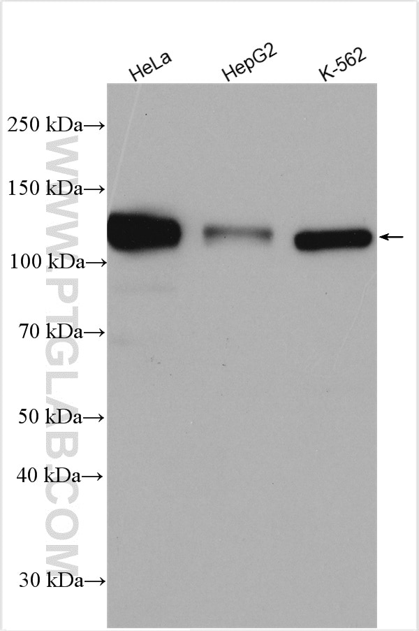 Western Blot (WB) analysis of various lysates using ROR2 Polyclonal antibody (25842-1-AP)
