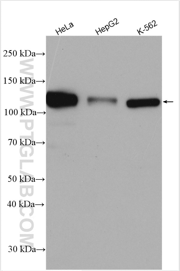 WB analysis using 25842-1-AP