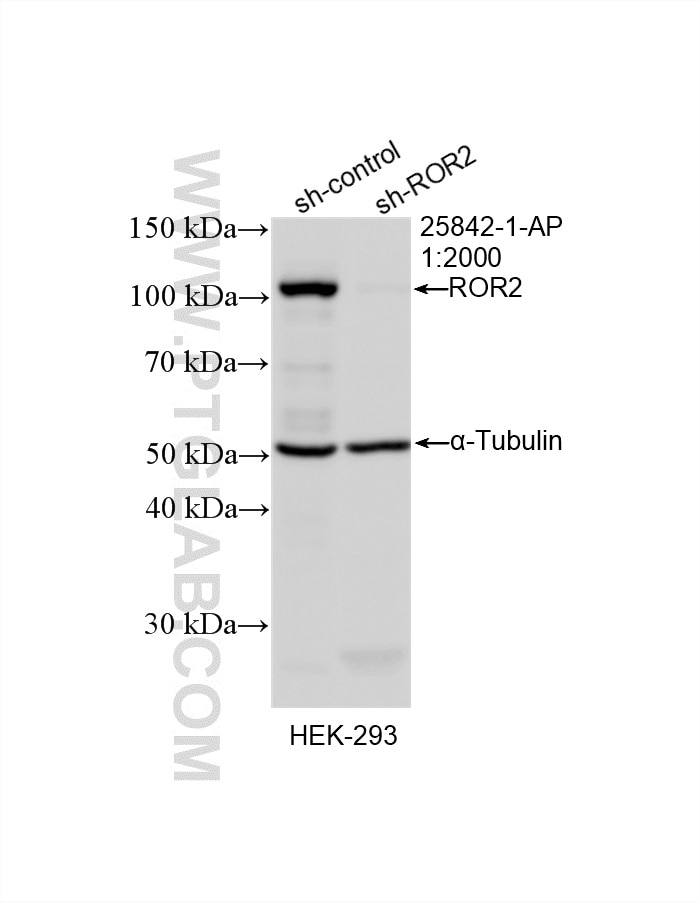 Western Blot (WB) analysis of HEK-293 cells using ROR2 Polyclonal antibody (25842-1-AP)