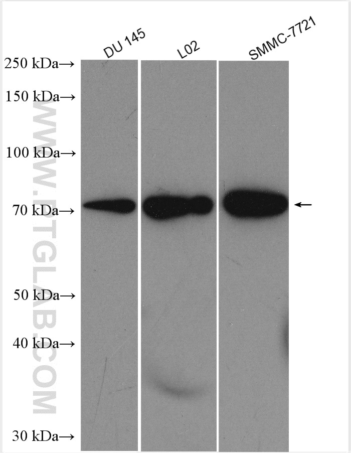 Western Blot (WB) analysis of various lysates using RORA Polyclonal antibody (10616-1-AP)