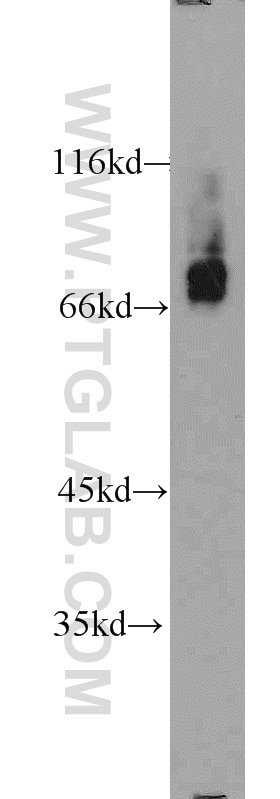 Western Blot (WB) analysis of K-562 cells using RORA Polyclonal antibody (10616-1-AP)
