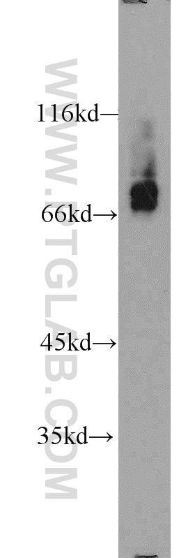 WB analysis of K-562 using 10616-1-AP