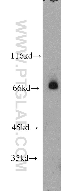 RORA Polyclonal antibody