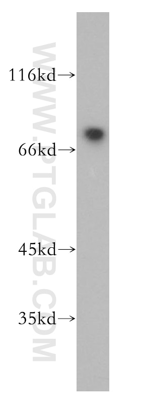 Western Blot (WB) analysis of Jurkat cells using RORA Polyclonal antibody (10616-1-AP)