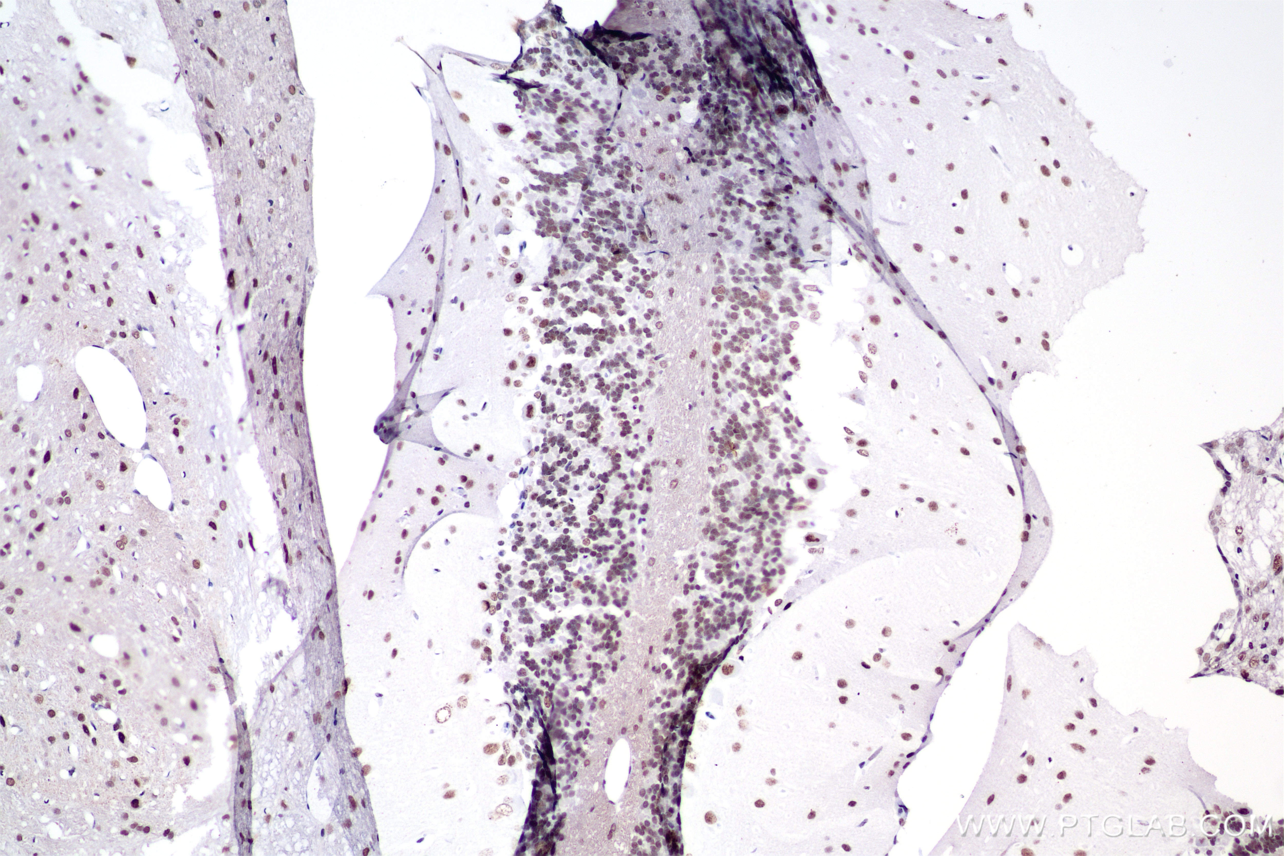 Immunohistochemistry (IHC) staining of rat cerebellum tissue using RORA Recombinant antibody, PBS Only (82930-1-PBS)