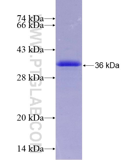 RORA antibody (10616-1-AP)