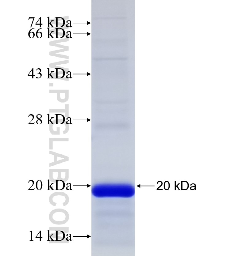 RORA fusion protein Ag32574 SDS-PAGE RORA fusion protein Ag32574 SDS-PAGE