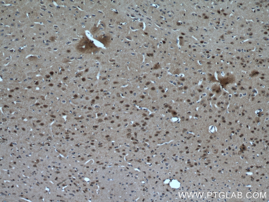 Immunohistochemistry (IHC) staining of mouse brain tissue using RORB Polyclonal antibody (17635-1-AP)