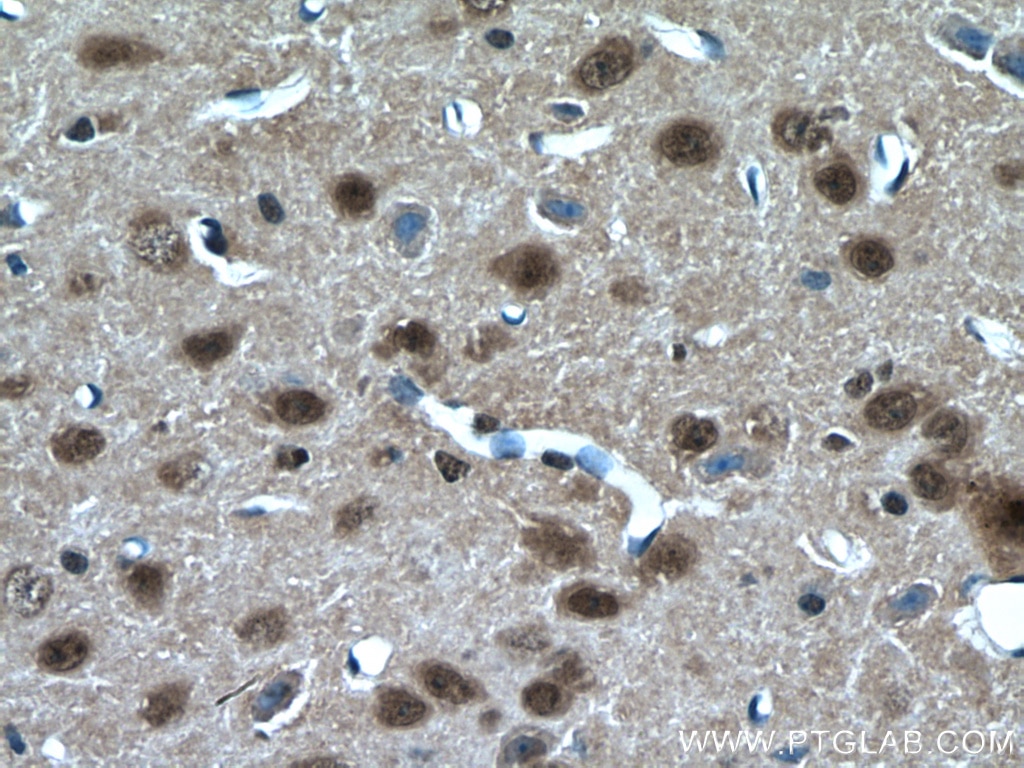 IHC staining of mouse brain using 17635-1-AP