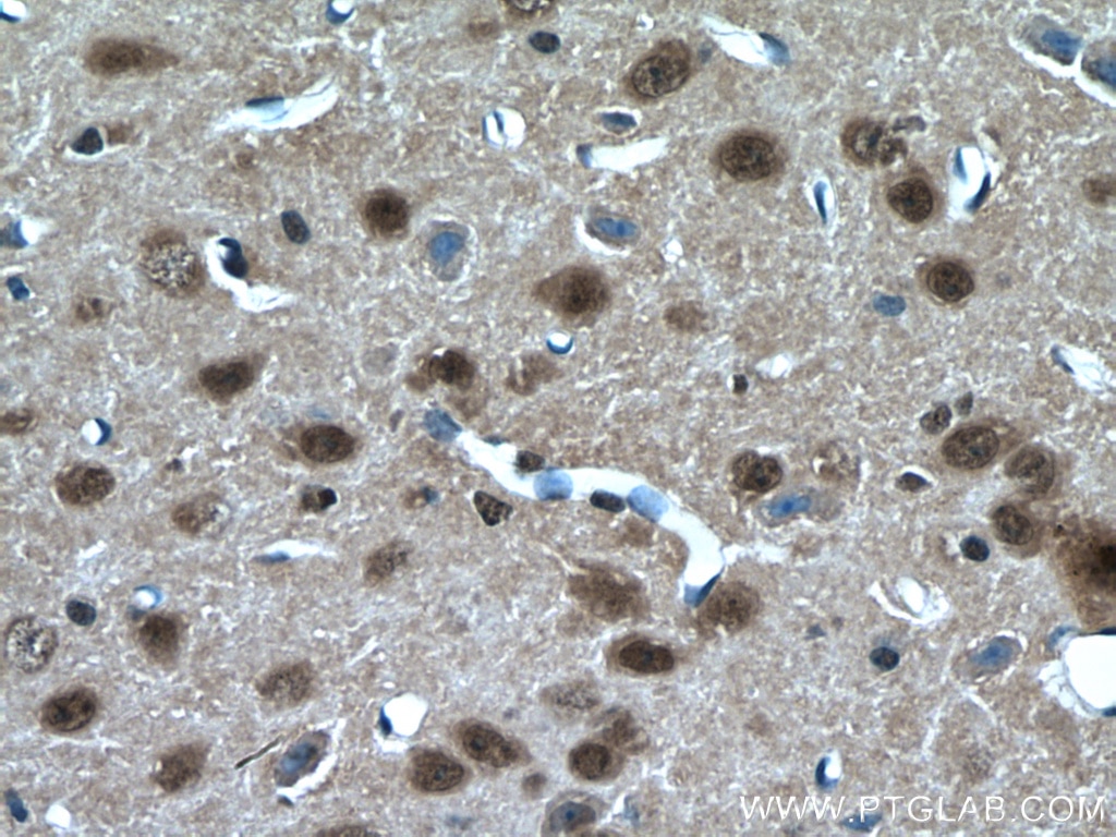 Immunohistochemistry (IHC) staining of mouse brain tissue using RORB Polyclonal antibody (17635-1-AP)