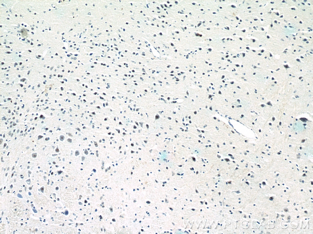 Immunohistochemistry (IHC) staining of mouse brain tissue using RORB Polyclonal antibody (17635-1-AP)