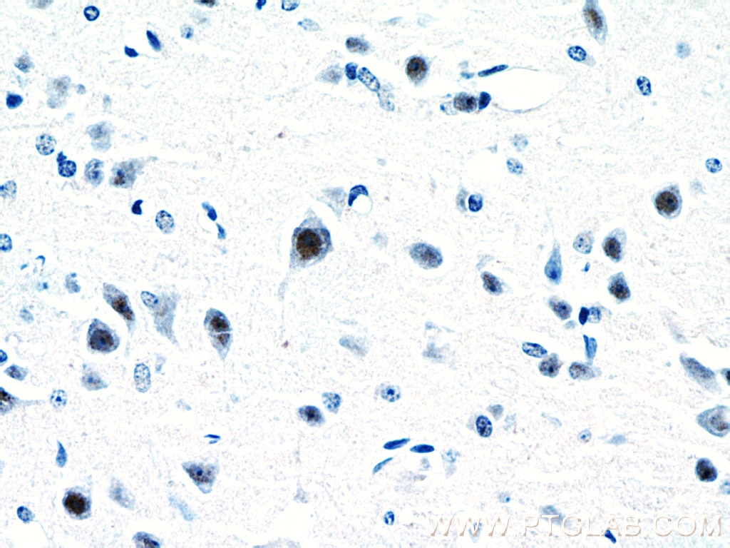 Immunohistochemistry (IHC) staining of mouse brain tissue using RORB Polyclonal antibody (17635-1-AP)