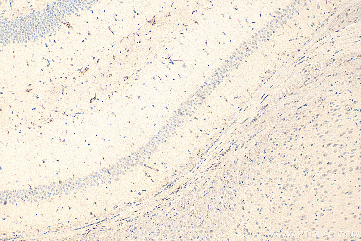 Immunohistochemistry (IHC) staining of mouse brain tissue using RORB Polyclonal antibody (17635-1-AP)