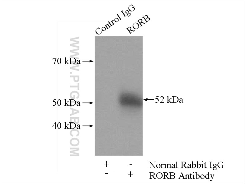 Immunoprecipitation (IP) experiment of mouse brain tissue using RORB Polyclonal antibody (17635-1-AP)