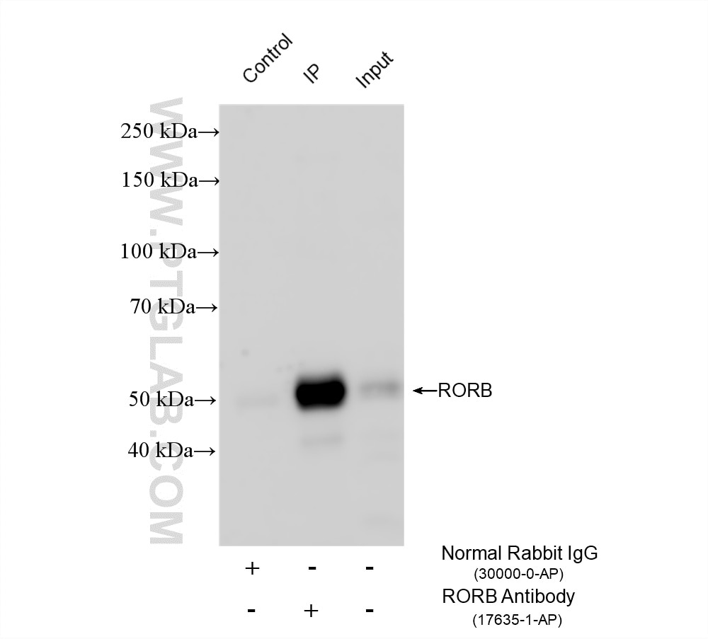 Immunoprecipitation (IP) experiment of mouse eye tissue using RORB Polyclonal antibody (17635-1-AP)