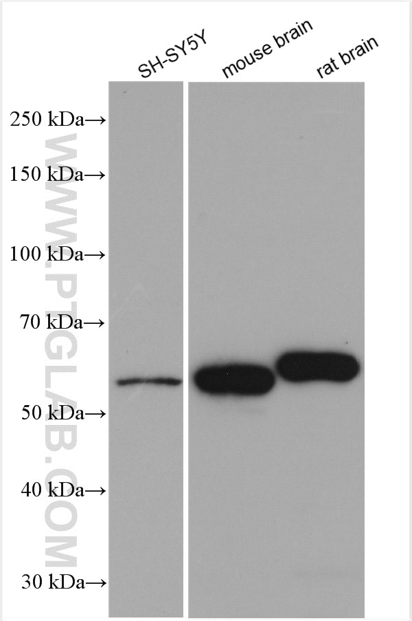 Western Blot (WB) analysis of various lysates using RORB Polyclonal antibody (17635-1-AP)