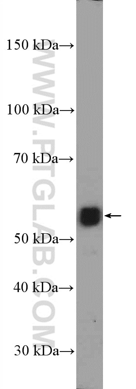 Western Blot (WB) analysis of mouse brain tissue using RORB Polyclonal antibody (17635-1-AP)