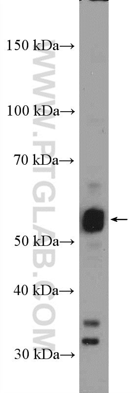 Western Blot (WB) analysis of mouse brain tissue using RORB Polyclonal antibody (17635-1-AP)