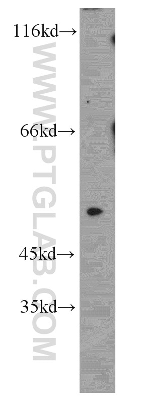 WB analysis of SH-SY5Y using 17635-1-AP