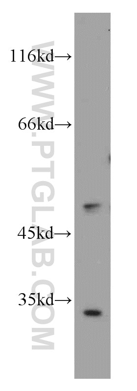 Western Blot (WB) analysis of SH-SY5Y cells using RORB Polyclonal antibody (17635-1-AP)