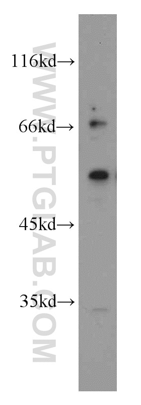 Western Blot (WB) analysis of Y79 cells using RORB Polyclonal antibody (17635-1-AP)