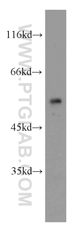 Western Blot (WB) analysis of Y79 cells using RORB Polyclonal antibody (17635-1-AP)