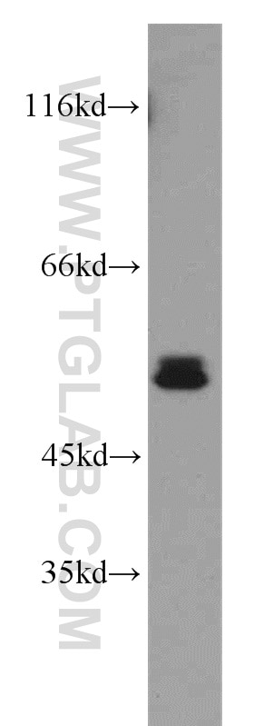 Western Blot (WB) analysis of Y79 cells using RORB Polyclonal antibody (17635-1-AP)