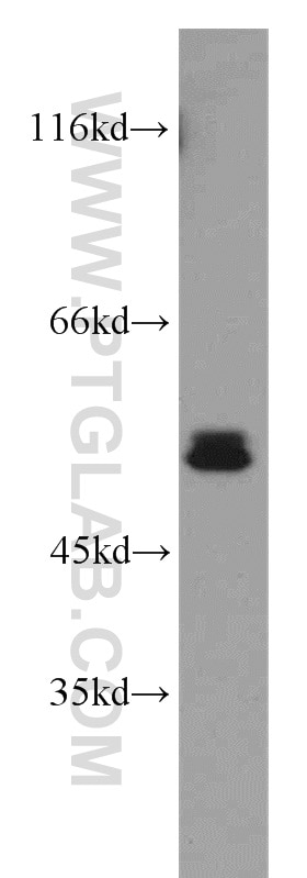 RORB Polyclonal antibody