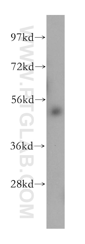 Western Blot (WB) analysis of Y79 cells using RORB Polyclonal antibody (17635-1-AP)