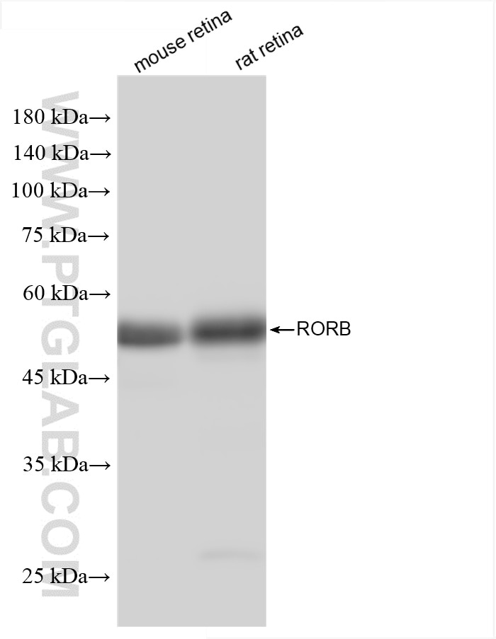 Western Blot (WB) analysis of various lysates using RORB Recombinant antibody (85404-4-RR)