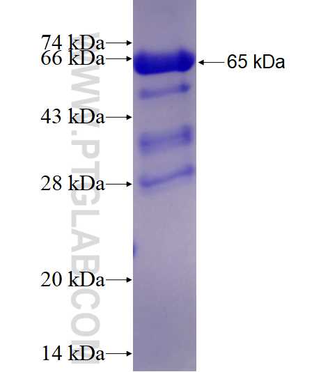 RORB fusion protein Ag11910 SDS-PAGE