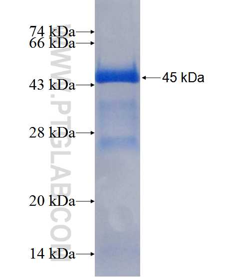 RORB fusion protein Ag11925 SDS-PAGE