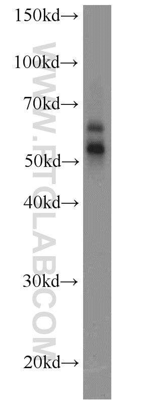 Western Blot (WB) analysis of Jurkat cells using RORC Polyclonal antibody (13205-1-AP)