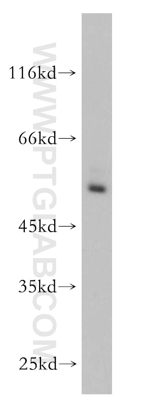 Western Blot (WB) analysis of HEK-293 cells using RORC Polyclonal antibody (13205-1-AP)