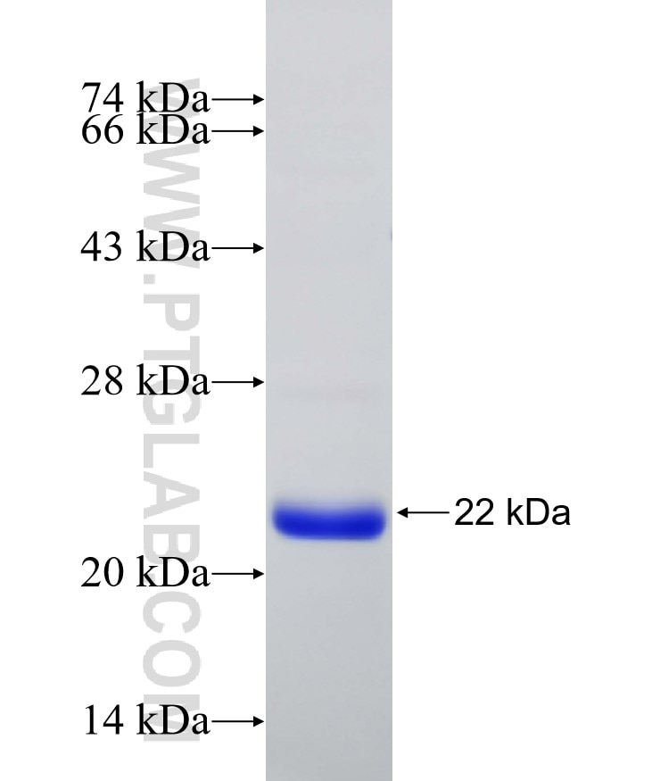 RORC fusion protein Ag31767 SDS-PAGE RORC fusion protein Ag31767 SDS-PAGE