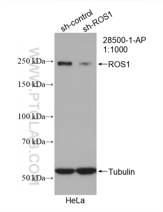Western Blot (WB) analysis of hela cells using ROS1 Polyclonal antibody (28500-1-AP)