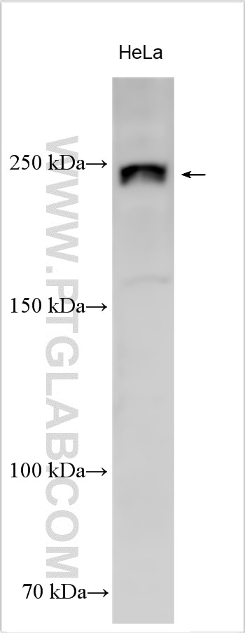 Western Blot (WB) analysis of various lysates using ROS1 Polyclonal antibody (28500-1-AP)