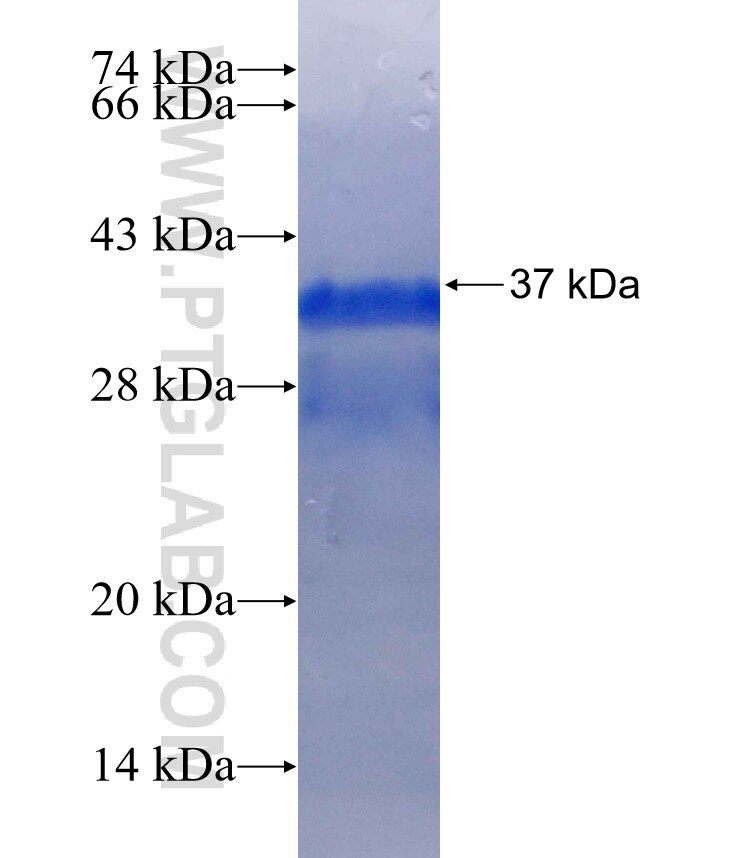 ROS1 fusion protein Ag25722 SDS-PAGE