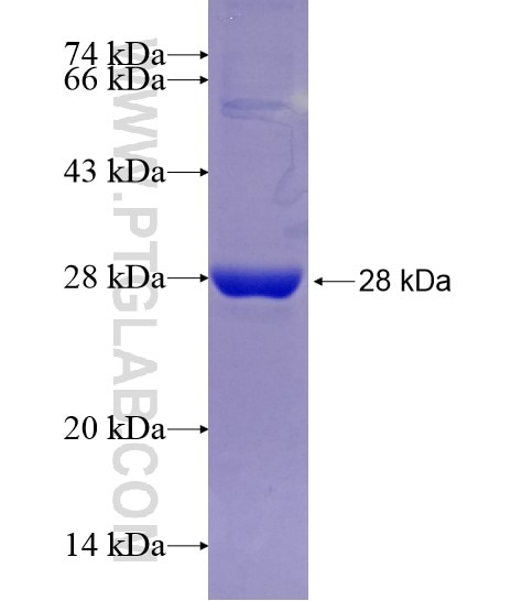 ROS1 fusion protein Ag28943 SDS-PAGE