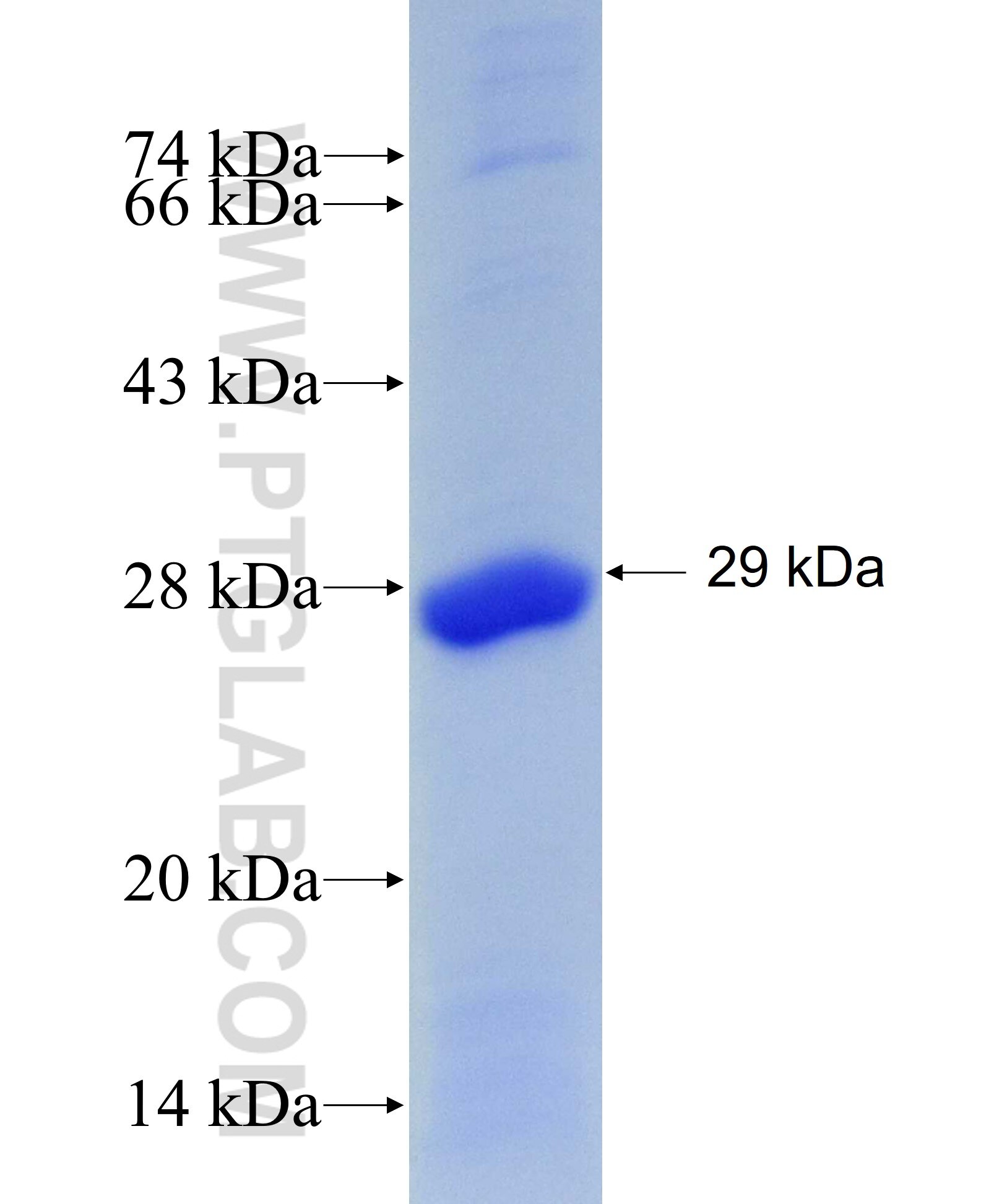 ROS1 fusion protein Ag28943 SDS-PAGE