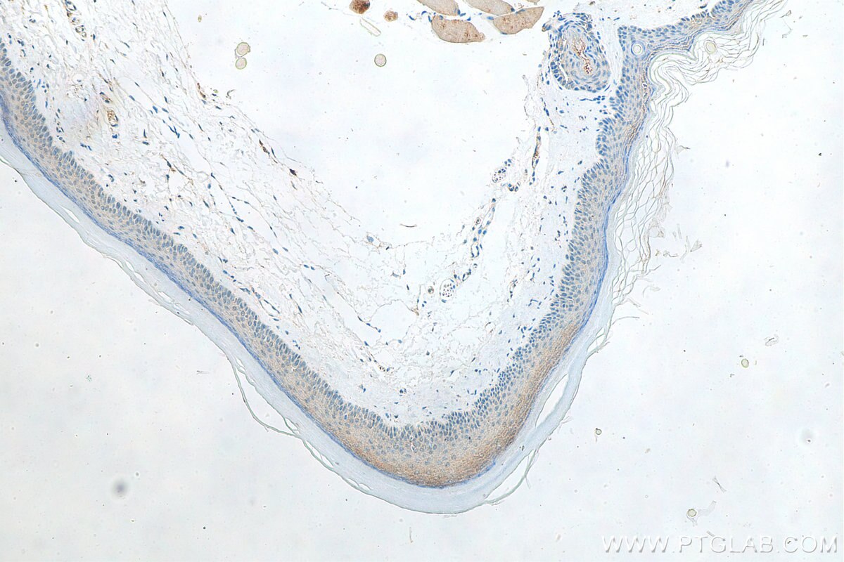 Immunohistochemistry (IHC) staining of mouse skin tissue using Kazrin Polyclonal antibody (11572-1-AP)