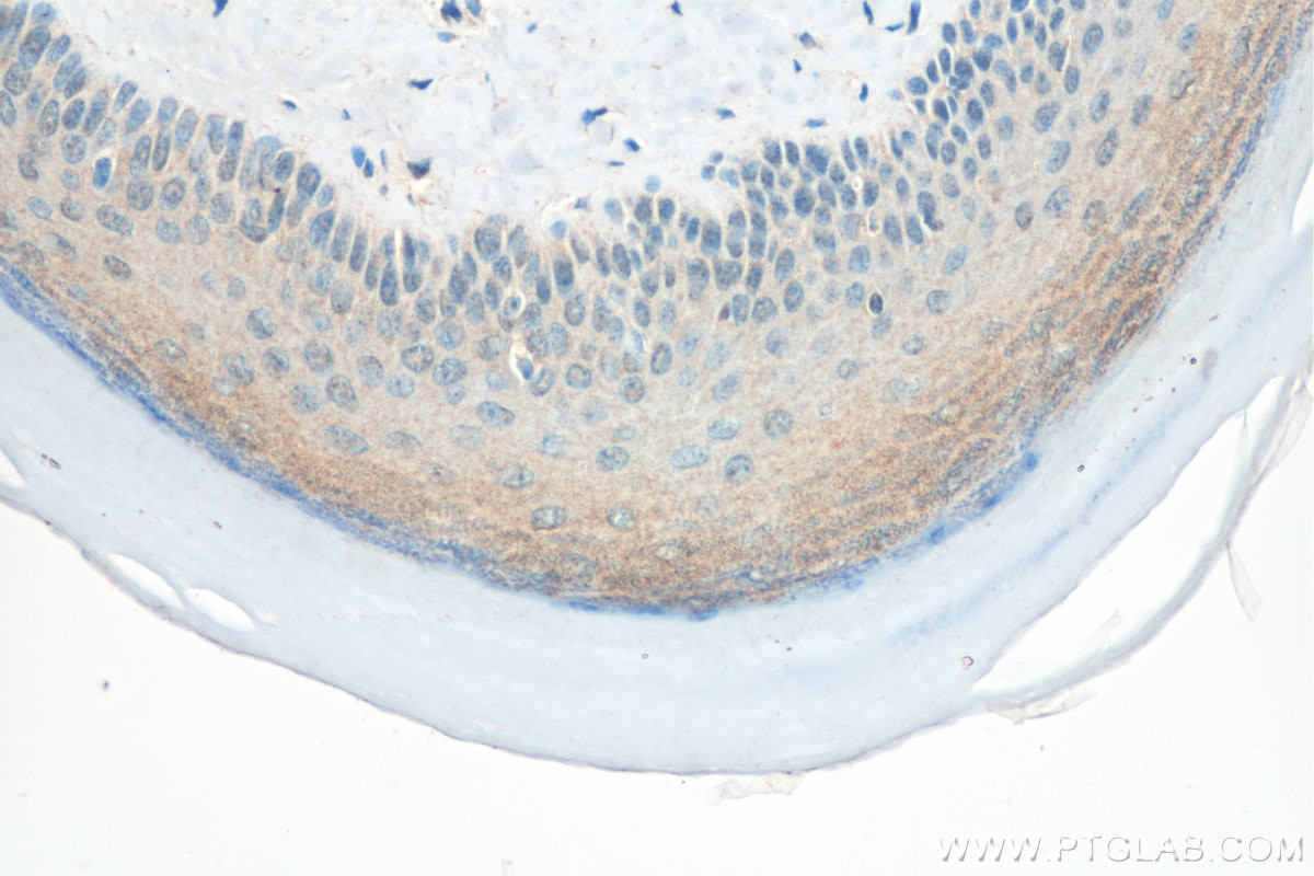 Immunohistochemistry (IHC) staining of mouse skin tissue using Kazrin Polyclonal antibody (11572-1-AP)