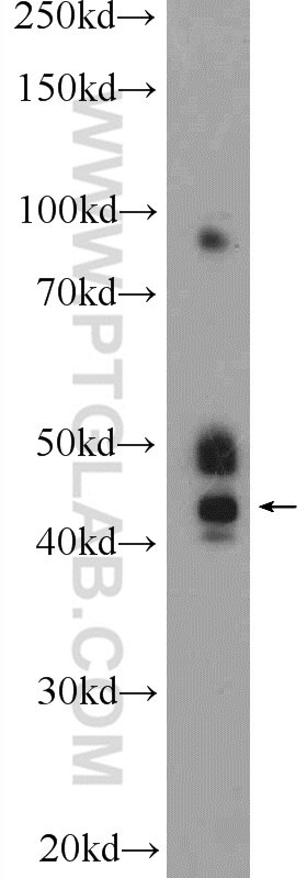 Western Blot (WB) analysis of mouse brain tissue using Kazrin Polyclonal antibody (11572-1-AP)