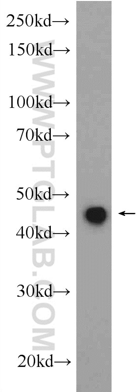 Western Blot (WB) analysis of mouse heart tissue using Kazrin Polyclonal antibody (11572-1-AP)