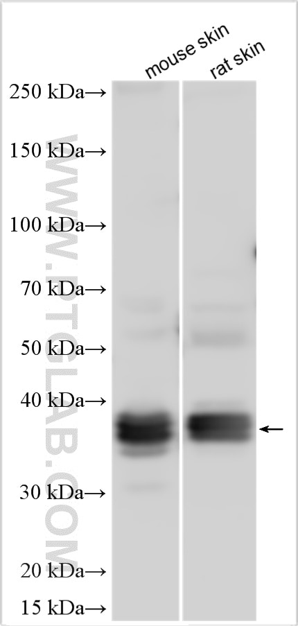 Western Blot (WB) analysis of various lysates using Kazrin Polyclonal antibody (11572-1-AP)