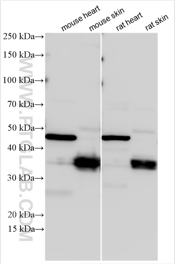 Western Blot (WB) analysis of various lysates using Kazrin Polyclonal antibody (11572-1-AP)