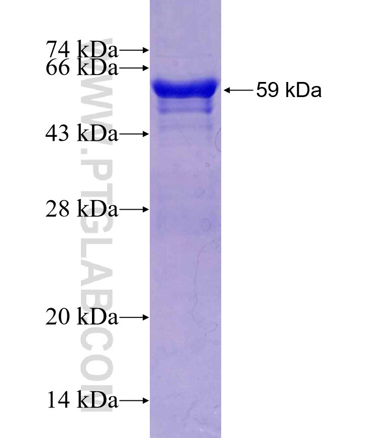 RP1-21O18.1 fusion protein Ag2152 SDS-PAGE