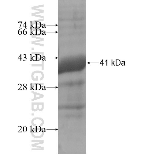 RP11-257K9.7 fusion protein Ag14354 SDS-PAGE