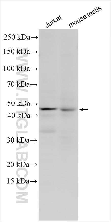 Western Blot (WB) analysis of various lysates using SLC35E2B Polyclonal antibody (17829-1-AP)
