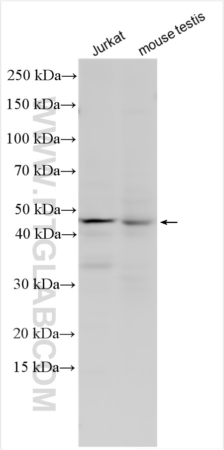 Western Blot (WB) analysis of various lysates using SLC35E2B Polyclonal antibody (17829-1-AP)